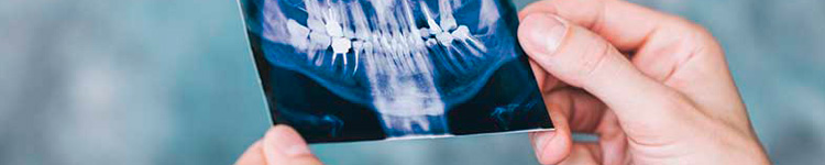 Рентген зубов в Химках