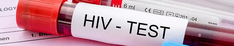 Анализы на ВИЧ в Химках